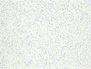 Sider-Proof roll on pool plaster - Speckled Blue